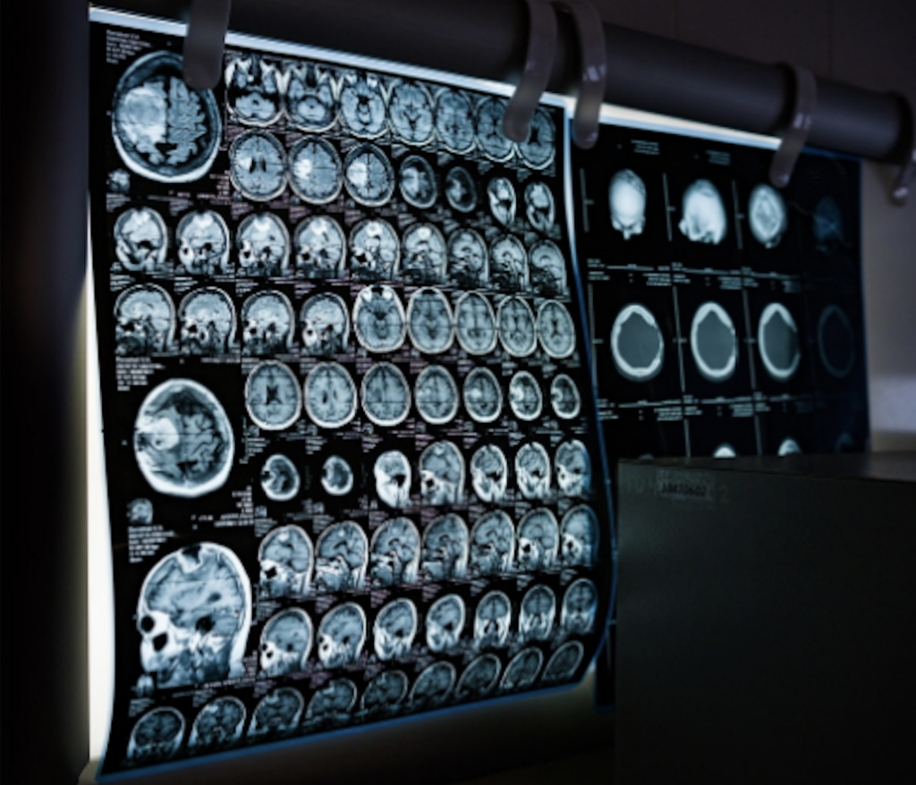 brain scans